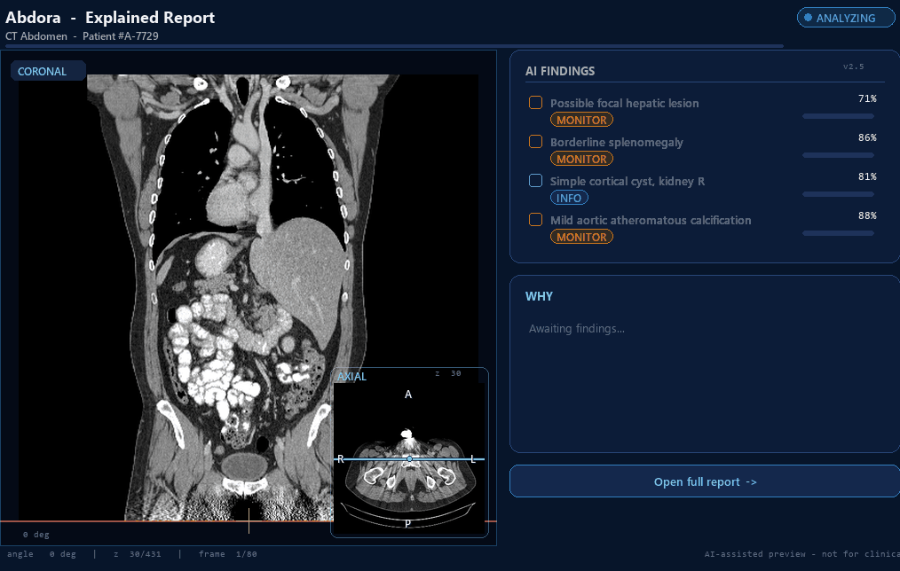 Abdora explained-report demo on a CT abdomen scan